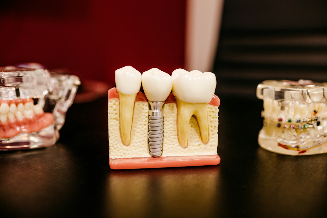 Dental implant model next to natural teeth