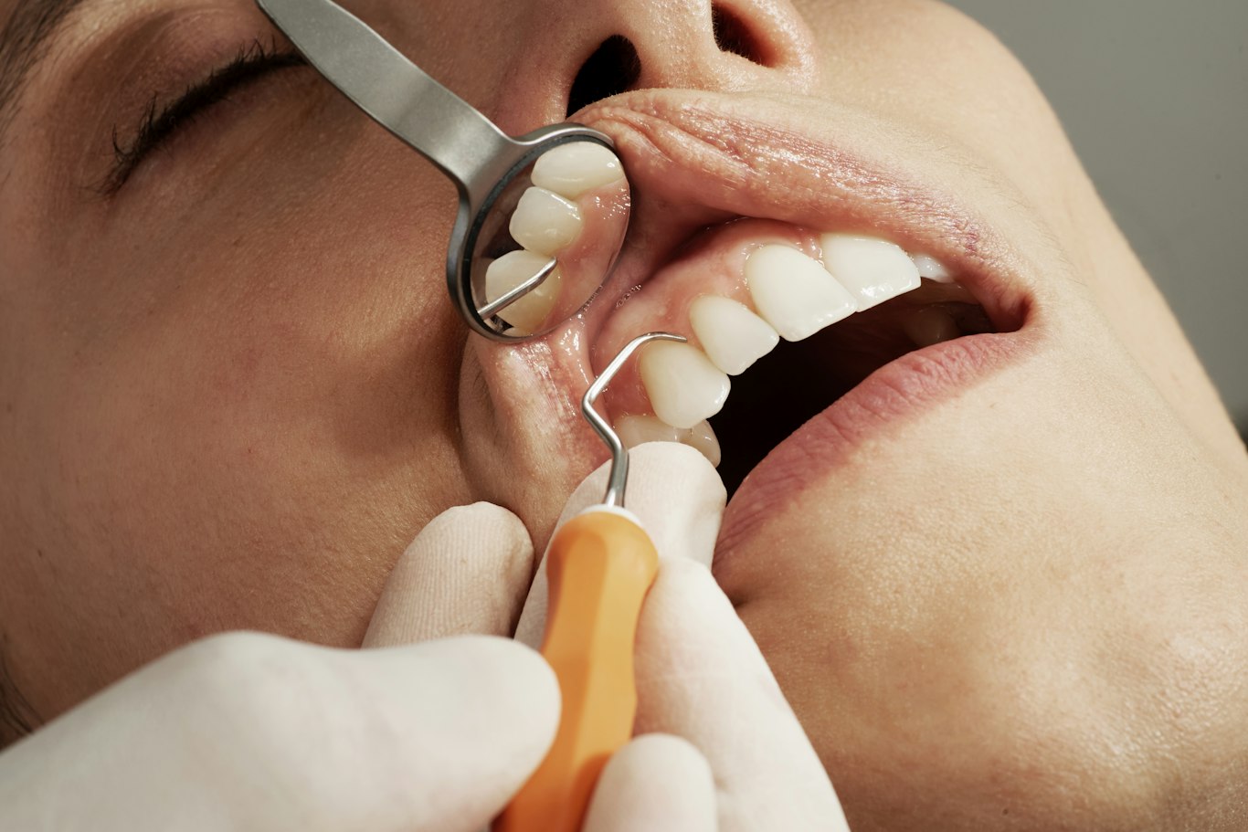 Dentist examining gums during a dental checkup