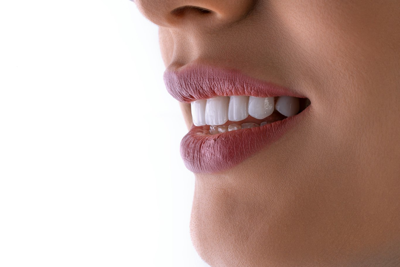 Close-up of a bright white smile after teeth whitening