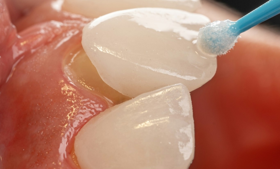 Close-up of cleaning between teeth, water flosser vs floss comparison